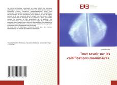 Couverture de Tout savoir sur les calcifications mammaires