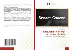 Bookcover of Signatures moléculaires des cancers du sein