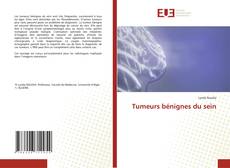 Copertina di Tumeurs bénignes du sein