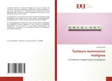 Bookcover of Tumeurs mammaires malignes