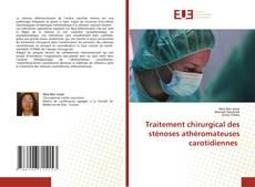 Traitement chirurgical des sténoses athéromateuses carotidiennes kitap kapağı