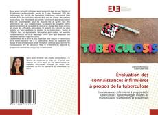 Copertina di Évaluation des connaissances infirmières à propos de la tuberculose