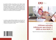 Lithiases calicielles inférieures: que choisir ? URSS vs mini-NLPC !? kitap kapağı