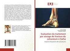 Evaluation du traitement par vissage de fracture du calcanéum à Gafsa kitap kapağı