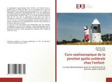 Bookcover of Cure coelioscopique de la jonction pyélo-urétérale chez l’enfant