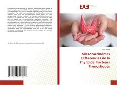 Copertina di Microcarcinomes Différenciés de la Thyroïde: Facteurs Pronostiques