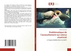 Bookcover of Problématique de l’accouchement sur uterus cicatriciel