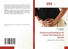 Bookcover of Facteurs pronostiques du cancer de l'estomac en Tunisie