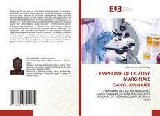 Bookcover of LYMPHOME DE LA ZONE MARGINALE GANGLIONNAIRE