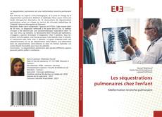 Bookcover of Les séquestrations pulmonaires chez l'enfant