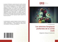 Bookcover of Les atteintes fongiques profondes de la cavité orale