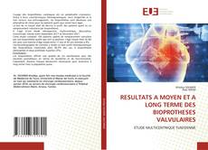 Bookcover of RESULTATS A MOYEN ET A LONG TERME DES BIOPROTHESES VALVULAIRES