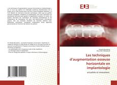 Bookcover of Les techniques d’augmentation osseuse horizontale en implantologie