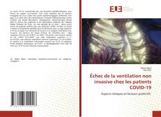 Couverture de Échec de la ventilation non invasive chez les patients COVID-19