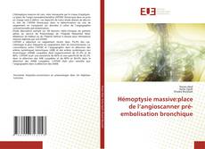 Bookcover of Hémoptysie massive:place de l’angioscanner pré-embolisation bronchique