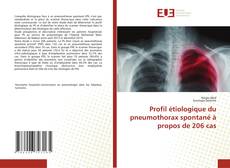 Bookcover of Profil étiologique du pneumothorax spontané à propos de 206 cas