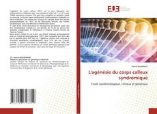 Bookcover of L'agénésie du corps calleux syndromique