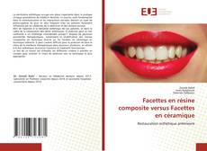 Copertina di Facettes en résine composite versus Facettes en céramique