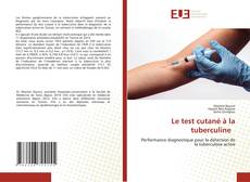 Bookcover of Le test cutané à la tuberculine