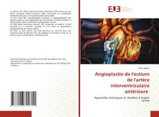 Bookcover of Angioplastie de l'ostium de l'artère interventriculaire antérieure