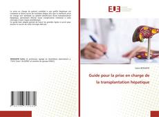 Bookcover of Guide pour la prise en charge de la transplantation hépatique