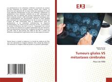 Couverture de Tumeurs gliales VS métastases cérébrales