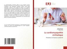 Bookcover of La cardiomyopathie cirrhotique