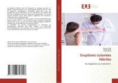 Couverture de Eruptions cutanées fébriles