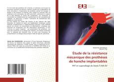 Couverture de Étude de la résistance mécanique des prothèses de hanche implantables