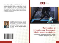 Couverture de Optimisation et Simulation de l'impression 3D des implants médicaux