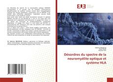 Couverture de Désordres du spectre de la neuromyélite optique et système HLA