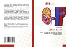 Couverture de Cancer du rein