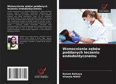 Wzmocnienie zębów poddanych leczeniu endodontycznemu的封面