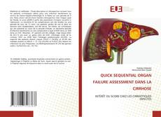 Portada del libro de QUICK SEQUENTIAL ORGAN FAILURE ASSESSMENT DANS LA CIRRHOSE