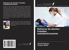 Refuerzo de dientes tratados endodónticamente的封面