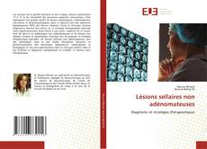 Lésions sellaires non adénomateuses的封面