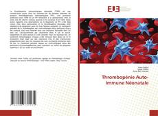 Copertina di Thrombopénie Auto-Immune Néonatale