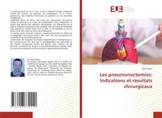 Buchcover von Les pneumonectomies: Indications et résultats chirurgicaux