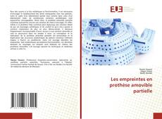 Les empreintes en prothèse amovible partielle的封面