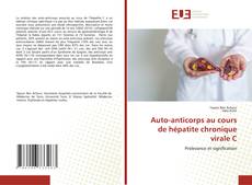 Bookcover of Auto-anticorps au cours de hépatite chronique virale C