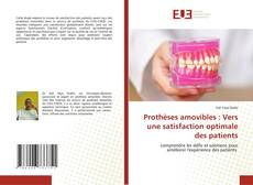 Prothèses amovibles : Vers une satisfaction optimale des patients的封面