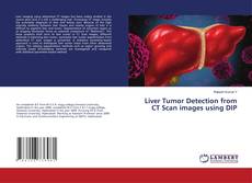 Liver Tumor Detection from CT Scan images using DIP的封面