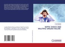 SEPTIC SHOCK AND MULTIPLE ORGAN FAILURE的封面