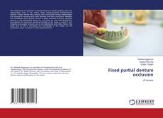 Couverture de Fixed partial denture occlusion