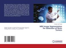 MRI Image Segmentation for Detection of Brain Tumors的封面