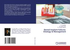 Couverture de Dental Implant Failures: Etiology & Management