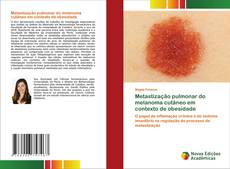 Buchcover von Metastização pulmonar do melanoma cutâneo em contexto de obesidade