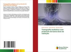 Bookcover of Tomografia multislice com protocolo de baixa dose de radiação