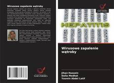 Borítókép a  Wirusowe zapalenie wątroby - hoz
