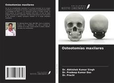 Portada del libro de Osteotomías maxilares